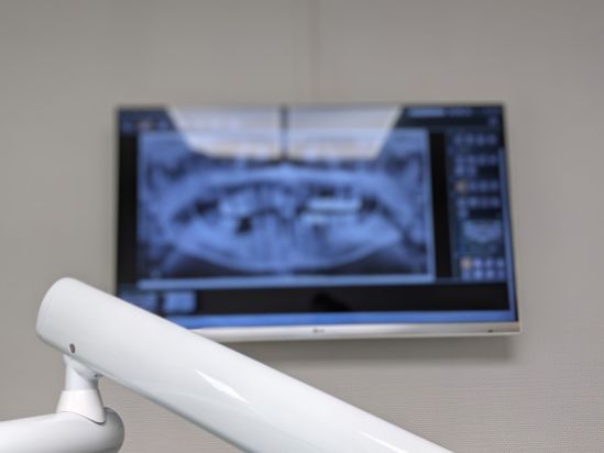 Unscharfe Röntgenaufnahme eines Gebisses auf einem großen Wandmonitor
