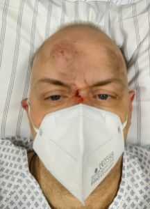 Selfie mit FFP2-Maske im Bett Ohne Brille, blutiger Stelle auf der Nase über der Maske, etwas wie eine Beule links oben und dreckige Stelle rechts auf der Stirn